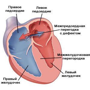 Алюминиевые окна установка в КАМЕШКОВО